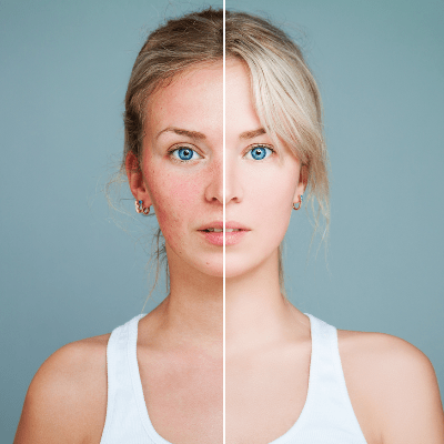 ANTI-AGING FACIALS
